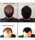 پودر پرپشت کننده مو و اسپری تثبیت کننده Building Fibers 28g Bottle of Fibers and Finally Hair of Fiber Lock Hair Spray