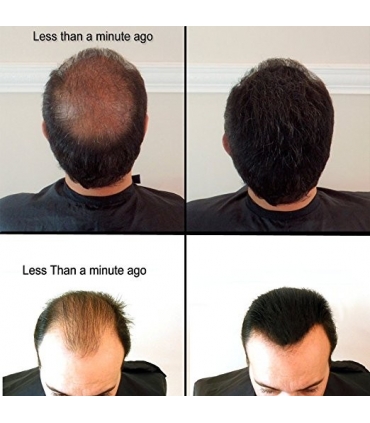 پودر پرپشت کننده مو و اسپری تثبیت کننده Building Fibers 28g Bottle of Fibers and Finally Hair of Fiber Lock Hair Spray