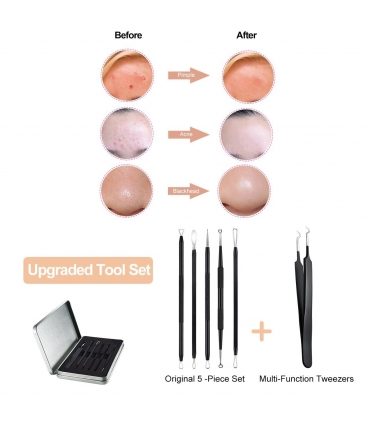 ست پاکسازی پوست اله سی ElleSye 6 PCS Pimple Comedone Extractor