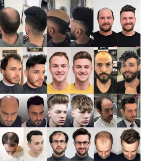 پوستیژ (کلاه گیس) مردانه موی صد در صد طبیعی انسان مشکی متوسط Toupee WBM 2117 virgin human hair replacement system for men