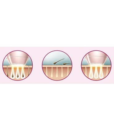 لیزر هوشمند خانگی فیلیپس لومه سری Philips Lumea BRI957