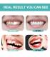 دندان مصنوعی کامپوزیت برای زیبایی JINHUA Fake Teeth